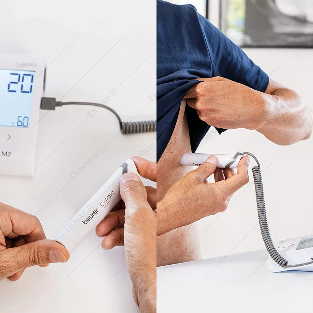 فشارسنج دیجیتال بازویی بیورر مدل BM 96 با ECG و تشخیص آریتمی